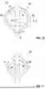 Fig. 08 - SLEEVE FOR A CATHETER