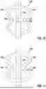 Fig. 10 - SLEEVE FOR A CATHETER