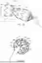 Fig. 11 - METHOD OF USE FOR DELIVERY SYSTEM FOR RADIALLY CONSTRICTING A STENT GRAFT