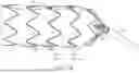 Fig. 13 - METHOD OF USE FOR DELIVERY SYSTEM FOR RADIALLY CONSTRICTING A STENT GRAFT