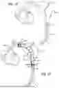 Fig. 10 - DELIVERY CATHETER FOR ENDOVASCULAR DEVICE