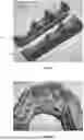 Fig. 02 - ORAL DEVICE TO INHIBIT MASTICATION AND INGESTION OF SOLID FOOD