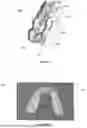 Fig. 10 - ORAL DEVICE TO INHIBIT MASTICATION AND INGESTION OF SOLID FOOD