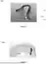 Fig. 11 - ORAL DEVICE TO INHIBIT MASTICATION AND INGESTION OF SOLID FOOD