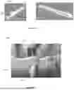 Fig. 12 - ORAL DEVICE TO INHIBIT MASTICATION AND INGESTION OF SOLID FOOD