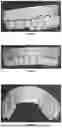 Fig. 15 - ORAL DEVICE TO INHIBIT MASTICATION AND INGESTION OF SOLID FOOD