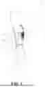 Fig. 04 - ADAPTABLE COMPRESSION SYSTEM FOR TREATING HYPOTENSION CRISIS EVENTS AND RELATED DEVICES AND METHODS