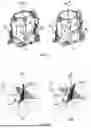 Fig. 04 - Wearable Head-Neck Traction Braces with Two End-Effector Degrees-of-Freedom