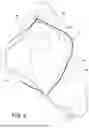 Fig. 04 - HERNIA BELT OSTOMY SUPPORT SYSTEM