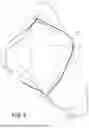 Fig. 05 - HERNIA BELT OSTOMY SUPPORT SYSTEM