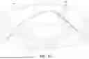 Fig. 09 - HERNIA BELT OSTOMY SUPPORT SYSTEM