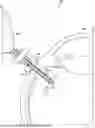 Fig. 01 - CANNULA CLEARANCE