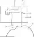 Fig. 01 - DEVICES AND METHODS FOR PROVIDING CONTROL DATA FOR AN OPHTHALMOLOGICAL LASER OF A TREATMENT APPARATUS FOR REDUCING GEOMETRIC IRREGULARITIES OF AN EYE