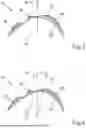 Fig. 03 - DEVICES AND METHODS FOR PROVIDING CONTROL DATA FOR AN OPHTHALMOLOGICAL LASER OF A TREATMENT APPARATUS FOR REDUCING GEOMETRIC IRREGULARITIES OF AN EYE