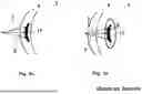 Fig. 02 - PLANNING METHODS AND DEVICES FOR PRECISELY CHANGING A REFRACTIVE INDEX