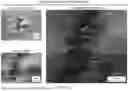 Fig. 16 - WOUND DRESSING WITH SEMI-RIGID SUPPORT TO INCREASE DISRUPTION USING PERFORATED DRESSING AND NEGATIVE PRESSURE WOUND THERAPY