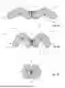 Fig. 08 - TAMPON INCLUDING SECONDARY ABSORBENT