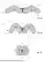 Fig. 08 - TAMPON INCLUDING SECONDARY ABSORBENT