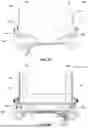 Fig. 32 - PATIENT POSITIONING SYSTEM