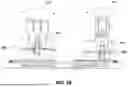 Fig. 33 - PATIENT POSITIONING SYSTEM