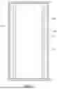 Fig. 03 - KNEE JOINT PHYSICAL THERAPY DEVICE