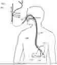 Fig. 01 - Smart Endoscope