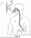 Fig. 05 - Smart Endoscope