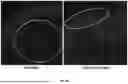 Fig. 31 - TOPICAL COMPOSITIONS AND METHODS FOR TREATING DERMATOPOROSIS