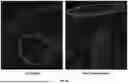 Fig. 33 - TOPICAL COMPOSITIONS AND METHODS FOR TREATING DERMATOPOROSIS