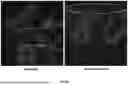 Fig. 34 - TOPICAL COMPOSITIONS AND METHODS FOR TREATING DERMATOPOROSIS