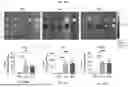 Fig. 112 - LIPID NANOPARTICLE (LNP) COMPOSITIONS FOR PLACENTA-SELECTIVE CARGO DELIVERY, AND METHODS OF USE THEREOF