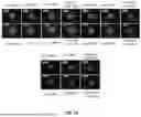 Fig. 14 - P-SELECTIN TARGETED NANOPARTICLES AND USES THEREOF