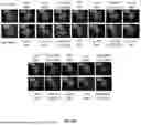 Fig. 16 - P-SELECTIN TARGETED NANOPARTICLES AND USES THEREOF