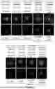 Fig. 19 - P-SELECTIN TARGETED NANOPARTICLES AND USES THEREOF