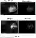 Fig. 23 - P-SELECTIN TARGETED NANOPARTICLES AND USES THEREOF