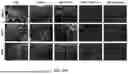 Fig. 27 - P-SELECTIN TARGETED NANOPARTICLES AND USES THEREOF