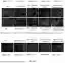 Fig. 54 - P-SELECTIN TARGETED NANOPARTICLES AND USES THEREOF