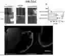 Fig. 11 - NANOPARTICLES FOR ENHANCED TRANSPORT ACROSS LYMPHATIC BARRIERS