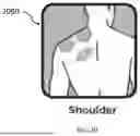 Fig. 21 - MODULAR TOPICAL PATCH SYSTEM FOR PAIN RELIEF