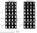 Fig. 13 - TRANSDERMAL DELIVERY DEVICE FOR PEPTIDE DELIVERY AND METHODS OF USE