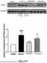 Fig. 17 - USE OF PHENOLIC ACIDS DERIVATIVES IN TREATING ISCHEMIC STROKE