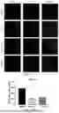 Fig. 18 - USE OF PHENOLIC ACIDS DERIVATIVES IN TREATING ISCHEMIC STROKE