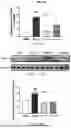 Fig. 19 - USE OF PHENOLIC ACIDS DERIVATIVES IN TREATING ISCHEMIC STROKE