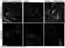 Fig. 01 - METHOD FOR TREATING AMYOTROPHIC LATERAL SCLEROSIS USING QUERCETIN-CONTAINING COMPOSITIONS