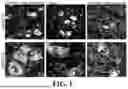 Fig. 02 - METHOD FOR TREATING AMYOTROPHIC LATERAL SCLEROSIS USING QUERCETIN-CONTAINING COMPOSITIONS