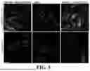 Fig. 04 - METHOD FOR TREATING AMYOTROPHIC LATERAL SCLEROSIS USING QUERCETIN-CONTAINING COMPOSITIONS