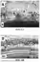 Fig. 02 - Method of Preventing Blast-Induced Loss of Cochlear and Vestibular Hair Cells and Auditory Spiral Ganglion Neurons