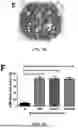 Fig. 07 - Method of Preventing Blast-Induced Loss of Cochlear and Vestibular Hair Cells and Auditory Spiral Ganglion Neurons