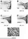 Fig. 08 - Method of Preventing Blast-Induced Loss of Cochlear and Vestibular Hair Cells and Auditory Spiral Ganglion Neurons