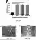 Fig. 09 - Method of Preventing Blast-Induced Loss of Cochlear and Vestibular Hair Cells and Auditory Spiral Ganglion Neurons